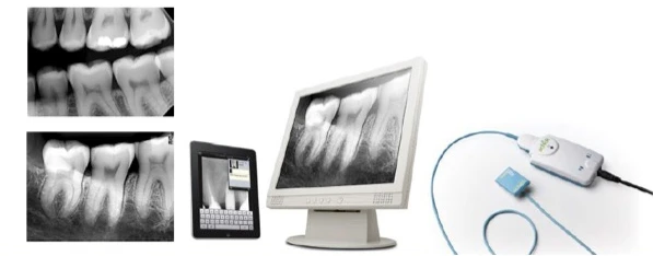Digital dental X-ray and intraoral imaging equipment
