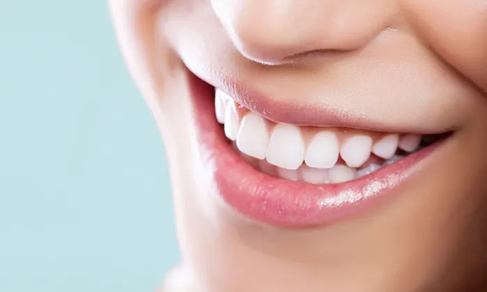 Healthy smile after periodontal care