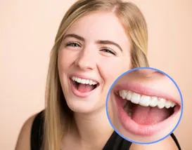 Orthodontic retainer treatment