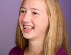 Orthodontic elastics