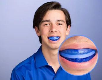 Sports mouthguard for tooth protection