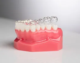 Clear orthodontic aligners